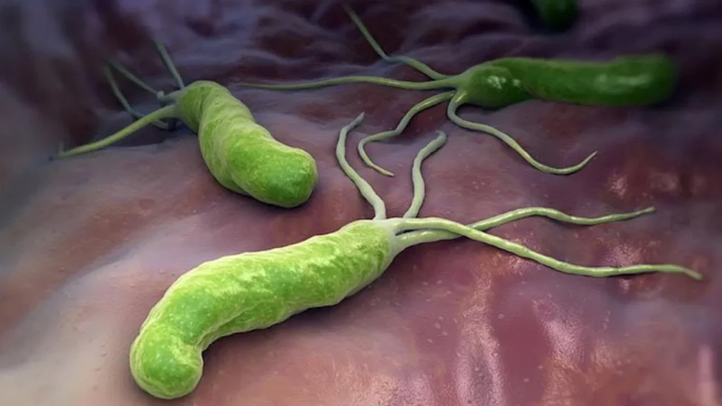 علاج جرثومة المعدة بالمنزل